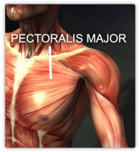 An Injury from Doing Bench Presses | Pectoralis Major Muscle Tear